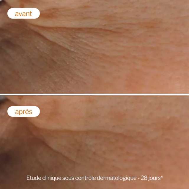 Trattamento peeling illuminante alla vitamina C